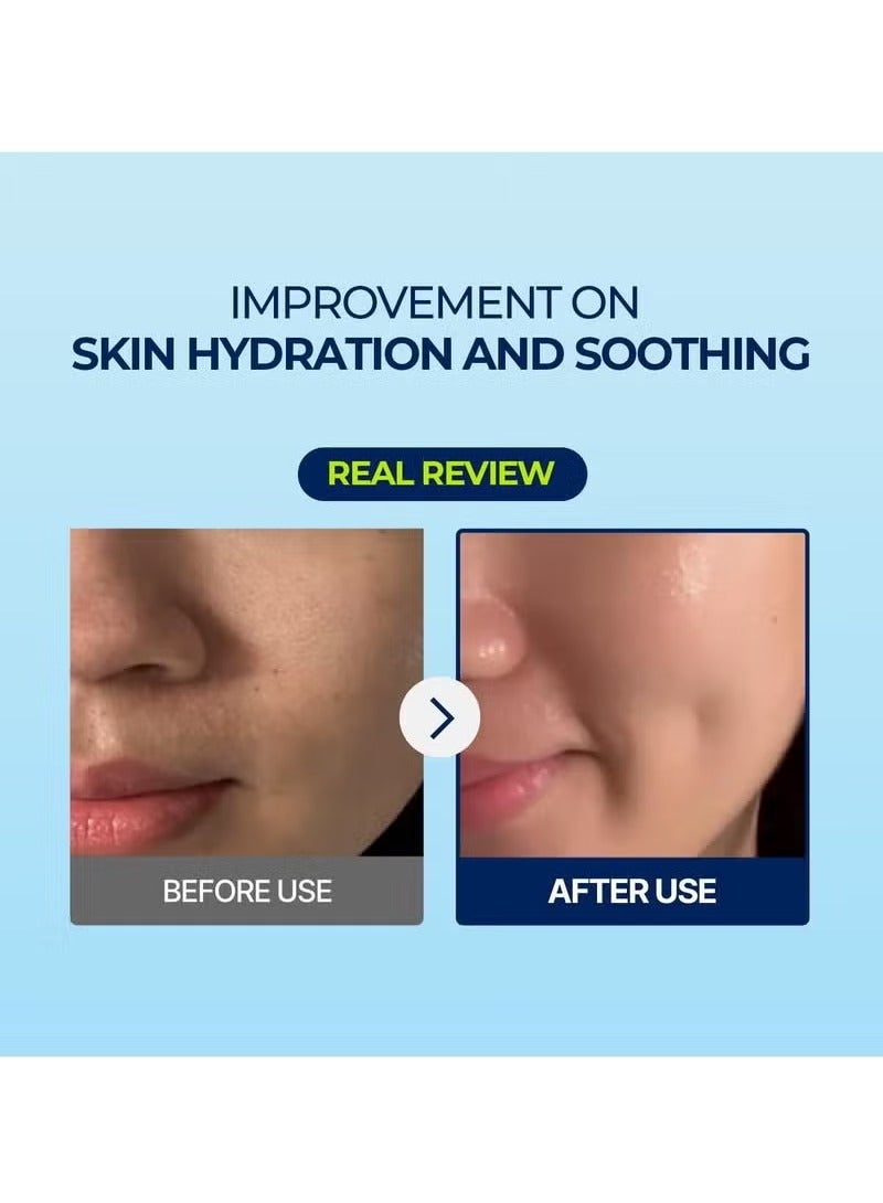 Torriden DIVE IN Hyaluronic Acid Facial Mask (10 sheets) | Extra Moisturizing Care | Hyaluronic Acid, Panthenol, Allantoin | Korean Face Mask - Image 3
