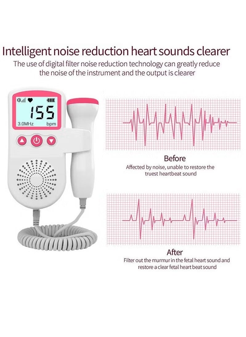 Gonice Portable Ultrasound Doppler Fetal Heart Rate Monitor with LCD Screen  - Image 4