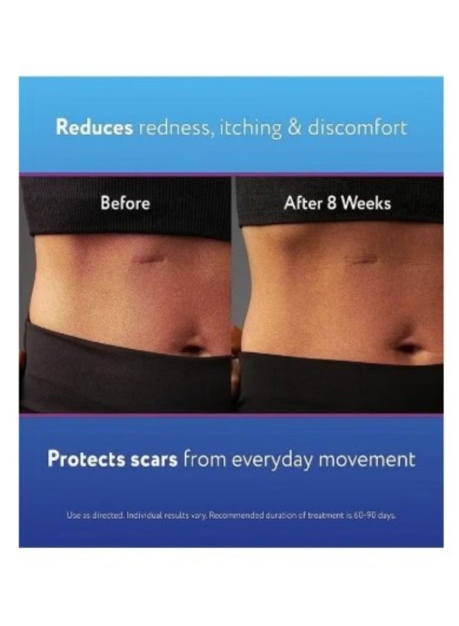 Kelo-cote Advanced Formula Scar Treatment Gel 15g - Image 5