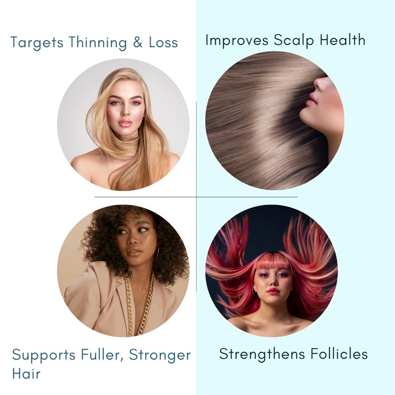 Morfose Scalp Treatment Anti Hair Loss Shampoo, 10.14 Fl Oz - Image 4