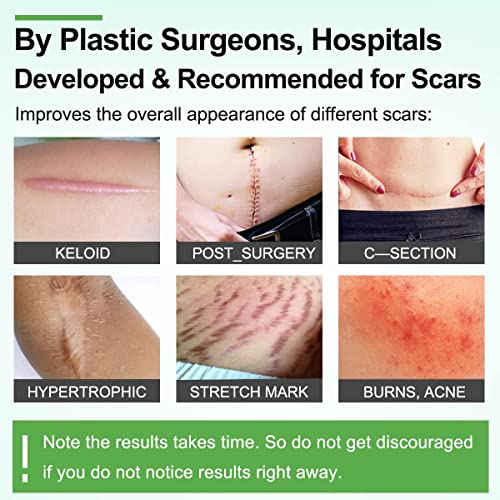 KWINTO Silicone Scar Sheets, Silicon gel sheets for Scars Transparent Medical Silicone Gel Tape for Scar Removal, Silicone Scar Tape Roll For Hypertrophic Scars and Keloids Caused by Surgery - Image 2