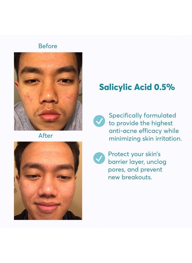 MDacne Hydrating Facial Cleanser With Micronized Salicylic Acid 0.5% Acne Treatment With Plantbased Ingredients To Remove Dirt & Oil Protect Skin & Unclog Pores Soothes Redness & Inflammation - Image 4
