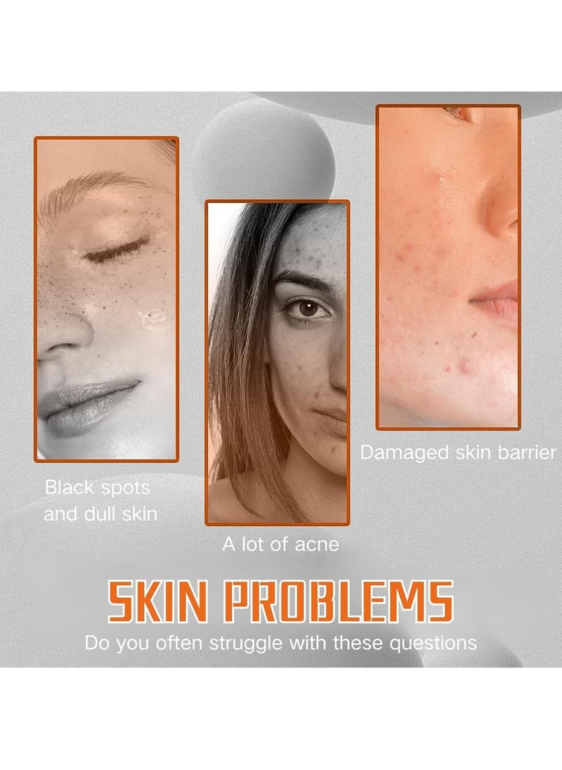 West&Month - Turmeric Face Toner, Hydrating Pore Minimizer & Exfoliating Toner – Brightening Skincare for Acne Reduction and Dark Spot Removal – Turmeric Oil Toner Serum for Clear, Radiant Skin 100ml - Image 1