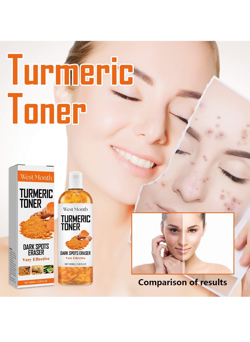 West&Month - Turmeric Face Toner, Hydrating Pore Minimizer & Exfoliating Toner – Brightening Skincare for Acne Reduction and Dark Spot Removal – Turmeric Oil Toner Serum for Clear, Radiant Skin 100ml - Image 1