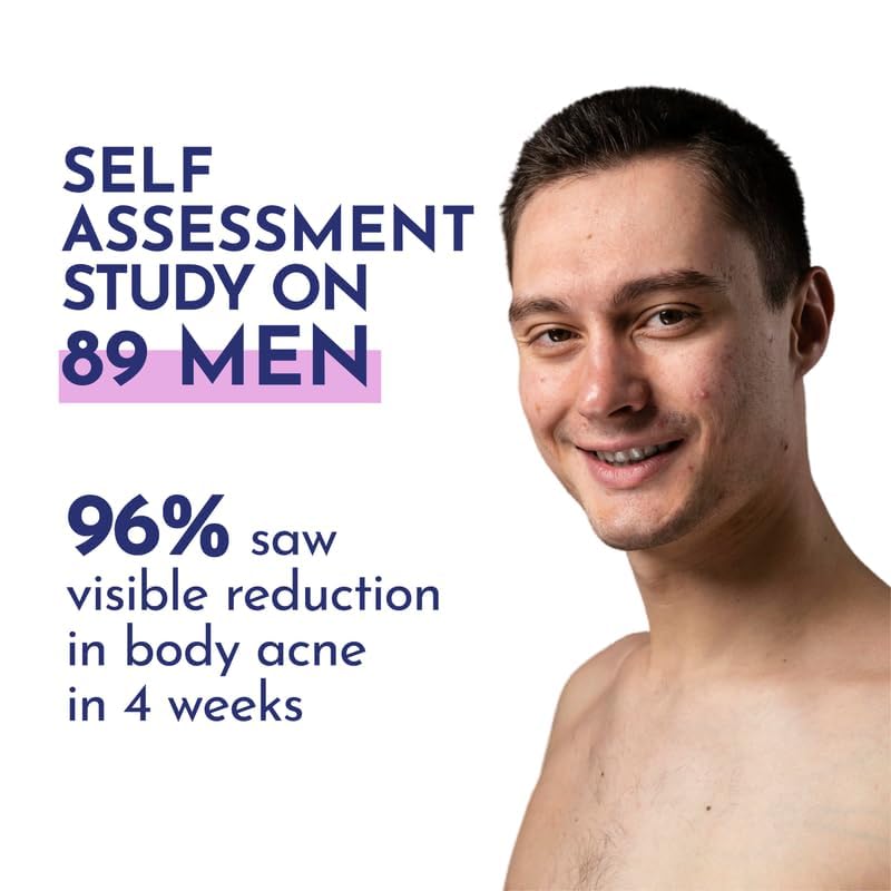 Mannlich غسول الجسم للرجال مانليخ 2 حمض الساليسيليك 300 مل غسول الجسم باكن كلير جل استحمام للرجال 3 نياسيناميد يمنع حب الشباب في الجسم يقشر ويغذي البشرة مناسب لجميع أنواع البشرة خالي من البارابين و SLS - Image 5