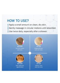 7 Days 7 Days Neck Cream for Acanthosis Nigricans | For Dark Body Parts Like Neck, Ankles, Knuckles, Armpits, Thighs, Elbows| Exfoliant 100gm  - Image 4