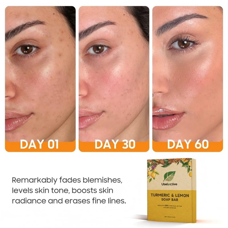 Uselective Lemon & Turmeric Glow Soap Bar for Dark Spots Remover, Powered by Kojic Acid & Vitamin C for Brightening & Fading Acne Scars - 3x Moisturizing with Shea Butter - SLS Free - Image 4