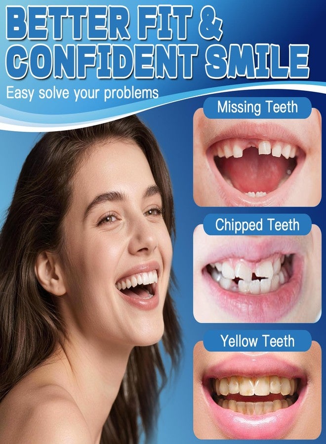Ceonam Moldable False Teeth Dentures Set for Women Men – Upper Lower Silicone Denture Kit with 0.7oz Dental Adhesive Beads, Plastic Tweezers, Storage Case, Natural Look Tooth - Image 3