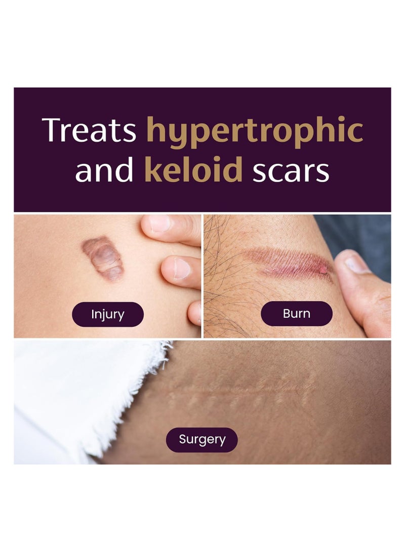 Mederma Medical Grade Silicone Scar Sheets 4 Count - Image 3