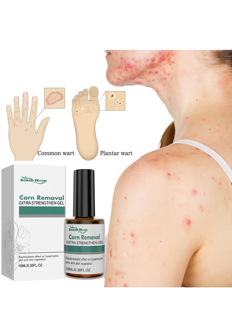ساوث مون إزالة الثآليل لليدين والقدمين، مزيل T-G لجلد الثؤلول، يزيل الثآليل بعمق، مزيل الثآليل يحتوي على مكونات طبيعية، سهل الاستخدام في المنزل 10 مل - Image 5