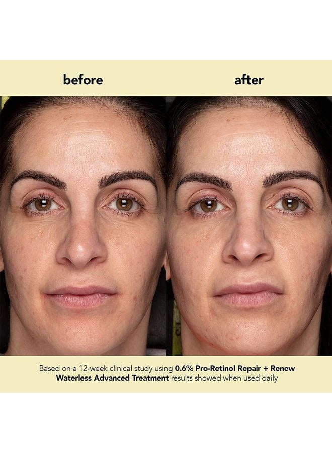 boscia boscia 0.6% Pro-Retinol Repair + Renew Waterless Advanced Treatment - Vegan, Cruelty-Free, Natural Skin Care - For Fine Lines & Wrinkles - 1 fl oz - Image 5