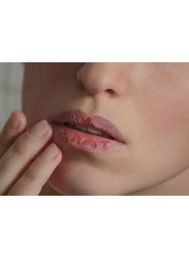 سيباميد حماية الشفاه للشفاه الجافة والمتشققة 4.8 جم - Image 2