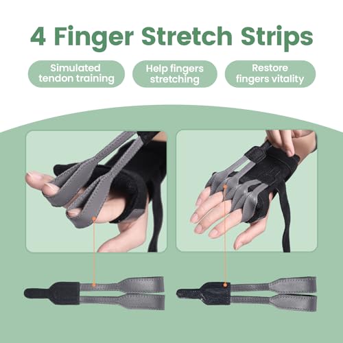 DrFinger جبيرة لعلاج شلل العصب الشعاعي لتمديد الأصابع، سقوط المعصم، شلل العكاز، جراحة مفصل الأصابع، إصابة العصب الشعاعي، ضعف الأصابع، التعافي من السكتة الدماغية، مثبت يد قابل للتعديل يناسب اليد اليمنى واليسرى - Image 4