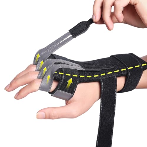 DrFinger جبيرة لعلاج شلل العصب الشعاعي لتمديد الأصابع، سقوط المعصم، شلل العكاز، جراحة مفصل الأصابع، إصابة العصب الشعاعي، ضعف الأصابع، التعافي من السكتة الدماغية، مثبت يد قابل للتعديل يناسب اليد اليمنى واليسرى - Image 1