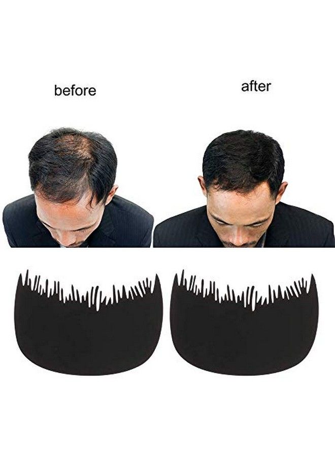 Kabello Protein Hair Building Fiber And Thickening Fibers With Hair Line Comb For Men And Women Pack Of 1 (Refill 12 Grams Black) - Image 5