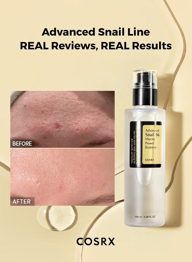 كوسرإكس Advanced Snail 96 Mucin Power Essence 100 مل. - Image 4
