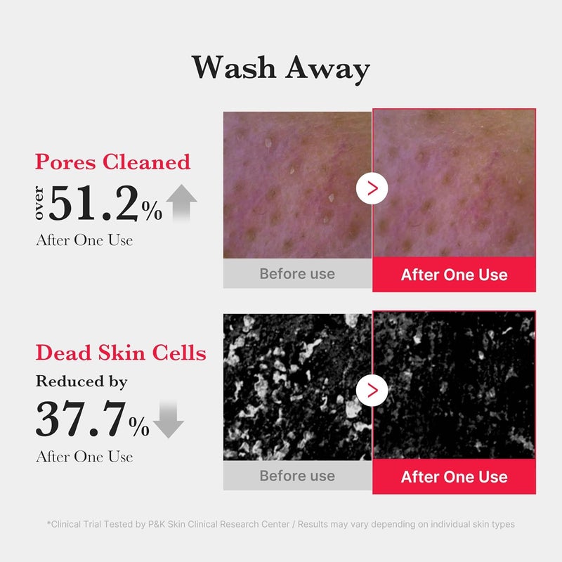 Medicube منظف رغوي أحمر، غسول وجه لطيف مع 0.45% حمض الساليسيليك للبشرة المعرضة لحب الشباب والحساسة، منظف وجه رغوي عميق ينظف الأوساخ والزيوت والمكياج، يتحكم في إفراز الدهون دون تجفيف - Image 3