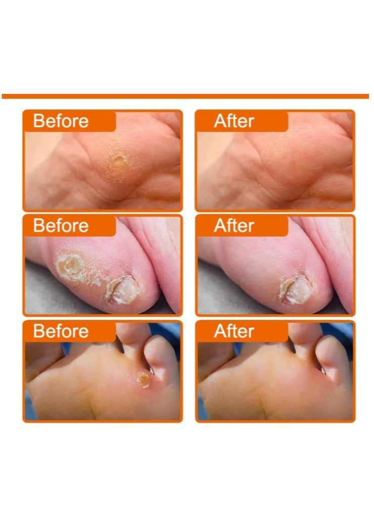 ERAYCEE Foot Corn Removal Plaster, Natural Ingredients, Foot Care Expert, Calluses Plantar Treatment, Relief Pain From Calluses, Corns, Blisters, Heel Frictions 10Pcs  - Image 5