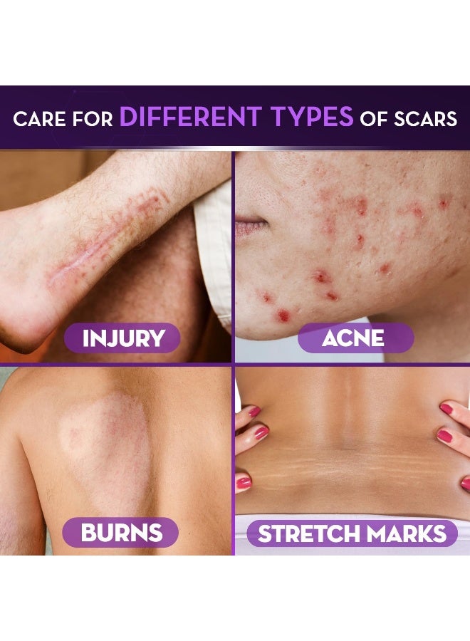 Cicatricure Face & Body Scar Gel - Image 4