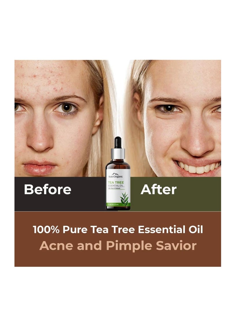 Aravi Organic Aravi Organic Tea Tree Oil for Skin Acne 15ml  - Image 3