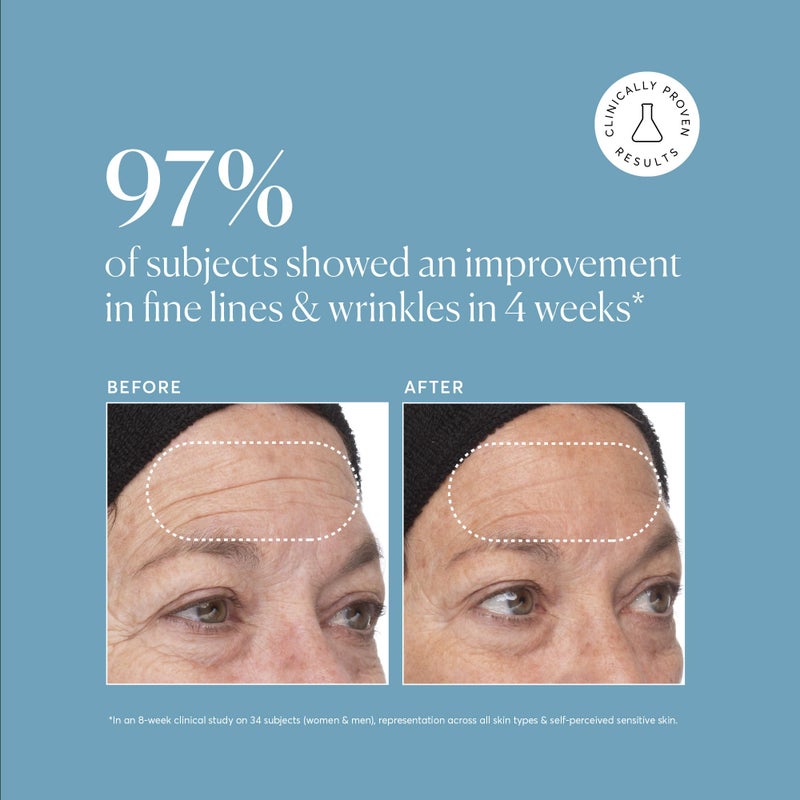 Naturium Retinol Complex Serum, Encapsulated Retinols & Bakuchiol, Refining & Smoothing Facial Serum, 1 oz - Image 3