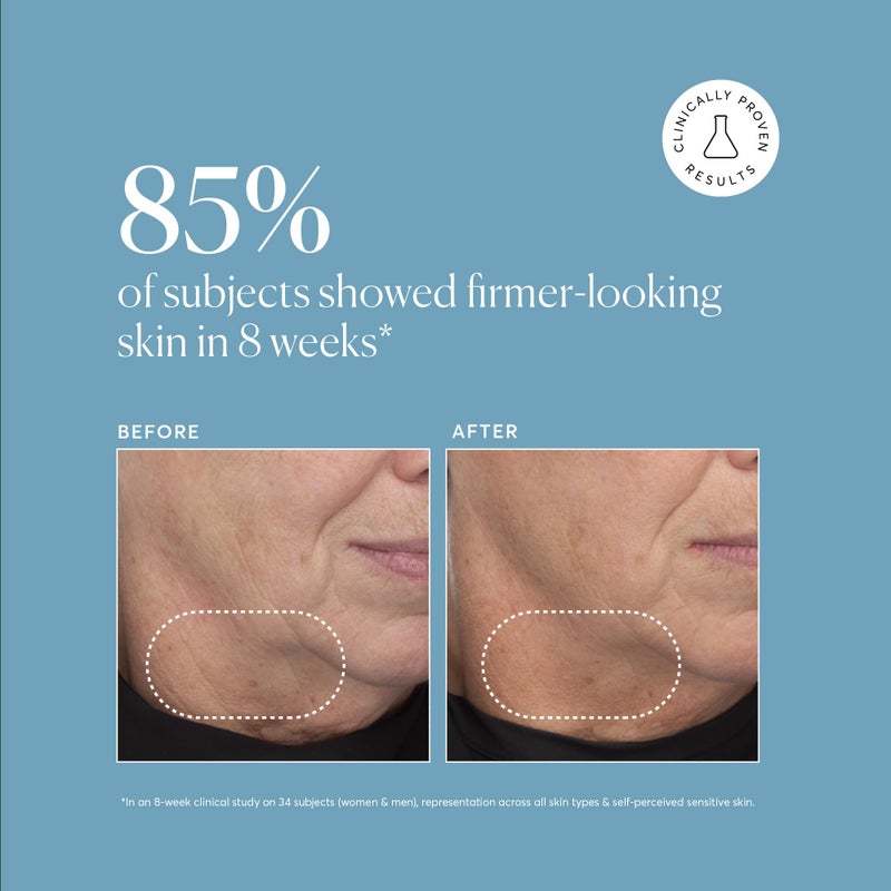 Naturium Retinol Complex Serum, Encapsulated Retinols & Bakuchiol, Refining & Smoothing Facial Serum, 1 oz - Image 4