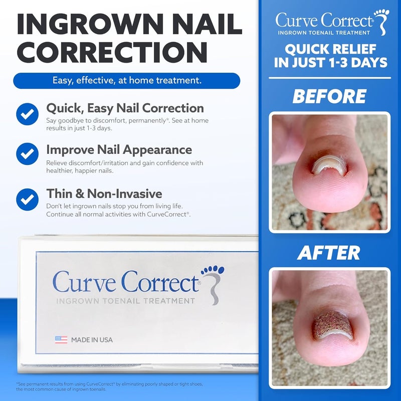 CurveCorrect طقم علاج الأظافر المنغرسة - طقم تصحيح الأظافر المنغرسة مع 10 دعامات - تصحيح الأظافر المنغرسة في المنزل - إزالة أظافر الإبهام المنغرسة - Image 4