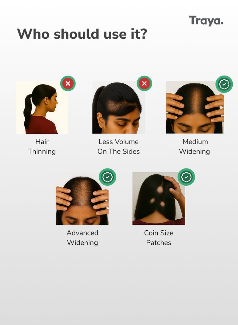 Traya Hair Regrowth Advanced Combo Kit for Women | Severe Widening and Hair Loss | Combo of 4 Products - Image 2