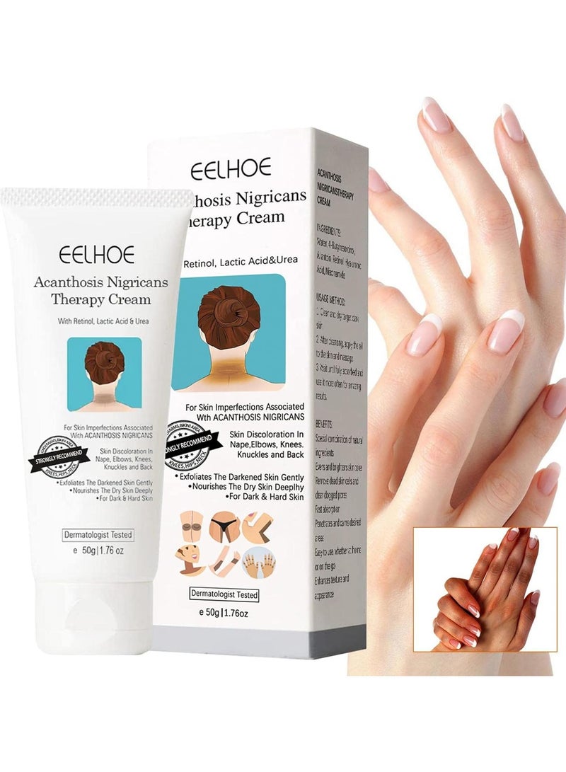 EELHOE Lightening Cream For Dark Spots | Acanthosis Nigricans Dark Skin Nourishing Cream - 1.76oz Soft Brightening Cream White Cream, Hydrating Cream for Joint Elbow Ffxs - Image 1