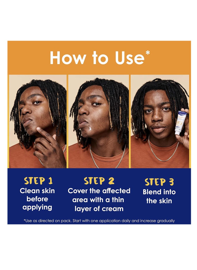 Clearasil - Clearasil Stubborn Acne Control 5in1 Spot Treatment Cream, Maximum Strenght with 10% Benzoyl Peroxide, Acne Medication, 1 oz - Image 1