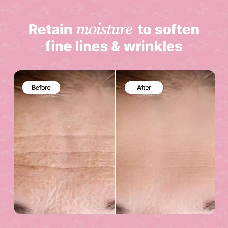 Bayside Forehead Wrinkle Patches | Anti-Wrinkle Facial Patches for Fine Lines | Overnight Wrinkle Filler & Deep Line Treatment | Disposable Face Tape for a Youthful, Firmer, and Smoother Appearance | 20 Count - Image 2