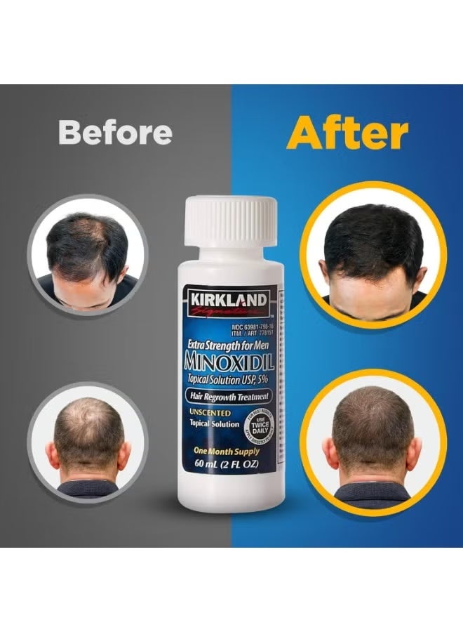 Kirkland 6 Bottles of 60ml Ultra - Strong 5% Minoxidil Hair Regrowth Treatment Set: Hassle - Free Hair Growth, Cost - effective Choice - Image 5