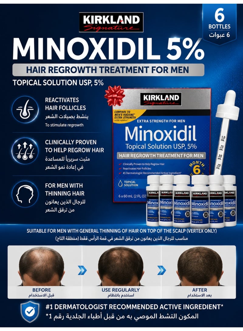 Kirkland 6 Bottles of 60ml Ultra - Strong 5% Minoxidil Hair Regrowth Treatment Set: Hassle - Free Hair Growth, Cost - effective Choice - Image 2