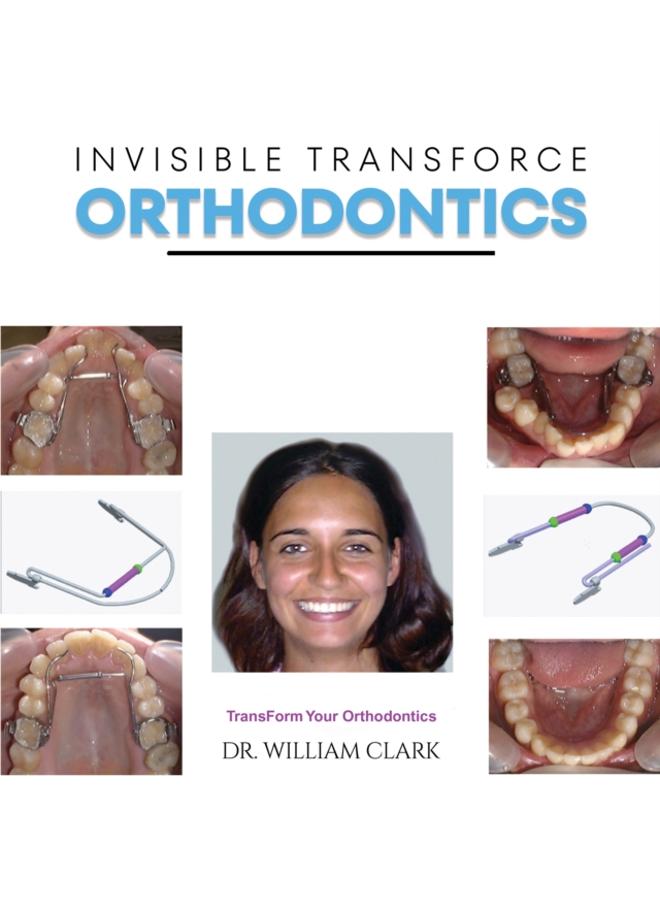 Invisible TransForce Orthodontics