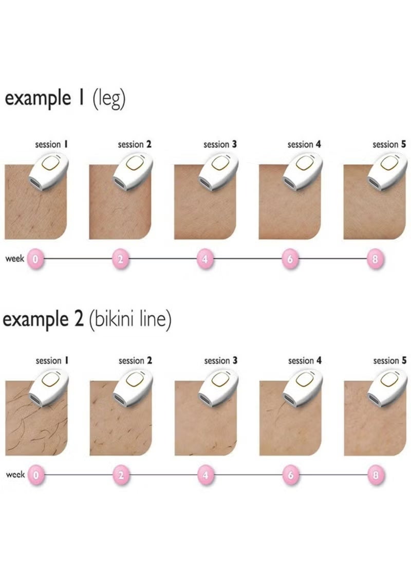 Laser Hair Removal IPL Epilators Device 500000 Flashes Epilators Hair Removal Machine Women Shaving Home Use Painless Body Shaver (Black) - Image 4