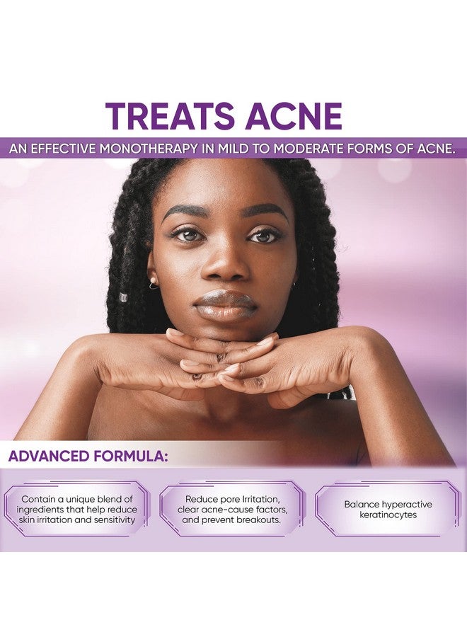 Aobbiy Azelaic Acid 10% Facial Cream For Redness Relief Face Rosacea Acne Treatment Pimple Pigmentation Blackhead Balance Excess Sebum Clarify Skin Soothe Irritation 1 Oz  - Image 5