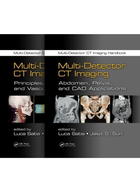 Multi-Detector CT Imaging Handbook, Two Volume Set