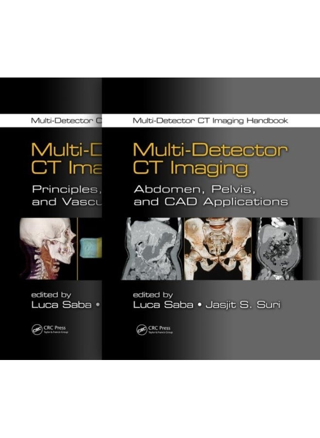 Multi-Detector CT Imaging Handbook, Two Volume Set