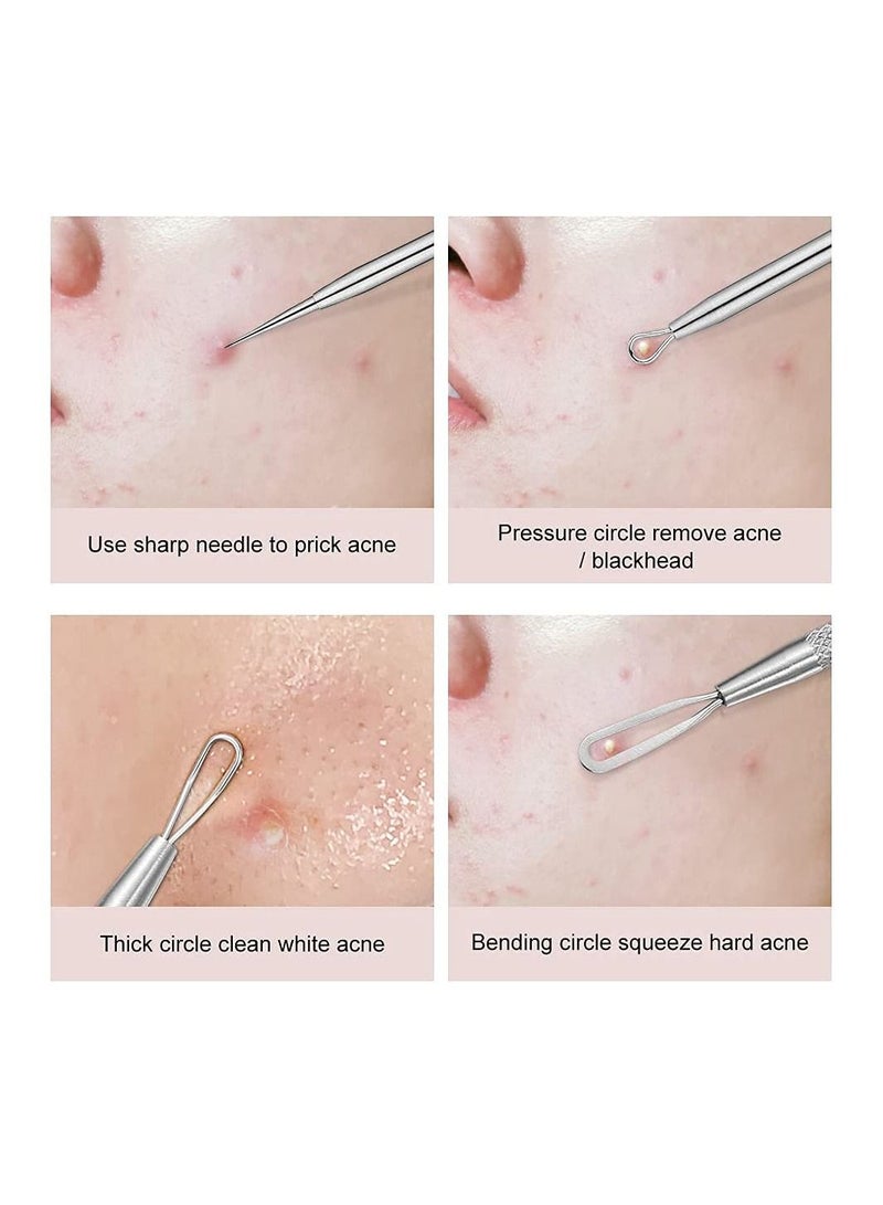 ORiTi Blackhead Remover Tool Kit 5 pcs, Stainless Steel Blackhead Removal Tool - Image 4