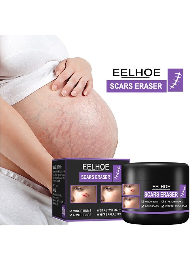 EELHOE Scars Eraser - Scar Removal Gel, Scar Removal Cream, Acne Scar Treatment，Deep Acne Scar Removal, Burns Keloids Hypertrophic, Repair Damaged Skin, Removing Acne Marks Scar Repair Cream 50g﻿ - Image 4