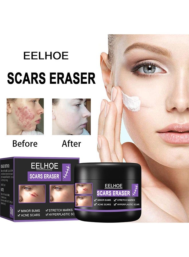 EELHOE Scars Eraser - Scar Removal Gel, Scar Removal Cream, Acne Scar Treatment，Deep Acne Scar Removal, Burns Keloids Hypertrophic, Repair Damaged Skin, Removing Acne Marks Scar Repair Cream 50g﻿ - Image 1