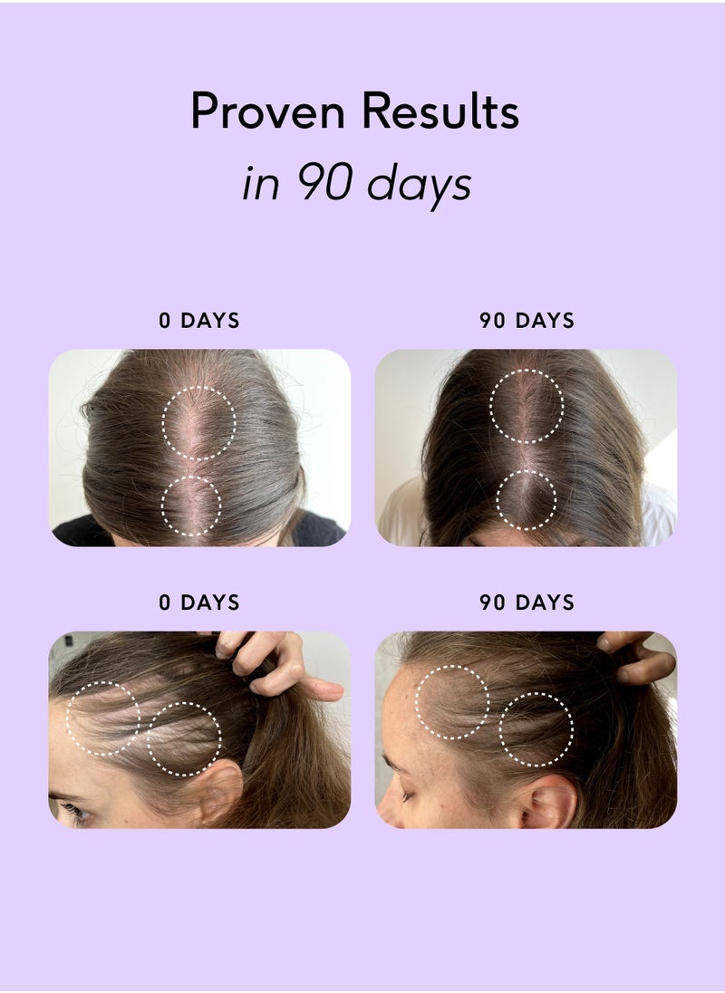 FEEL - Feel Hair Support - Hair Growth Supplement - Natural Support for Thinning Hair with Keranat and Biotin - Strengthens Hair Follicles, Boosts Shine and Volume - 100% Halal, Vegan - 30 Capsules - Image 1