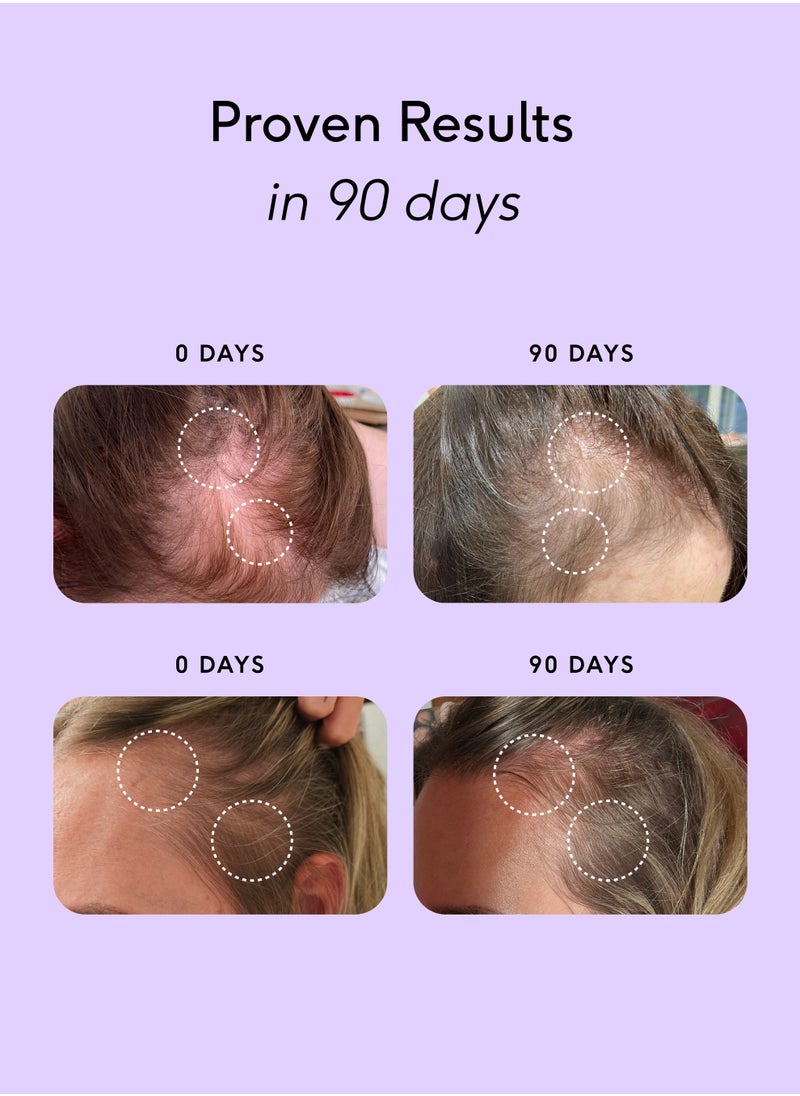 FEEL - Feel Hair Support - Hair Growth Supplement - Natural Support for Thinning Hair with Keranat and Biotin - Strengthens Hair Follicles, Boosts Shine and Volume - 100% Halal, Vegan - 30 Capsules - Image 1