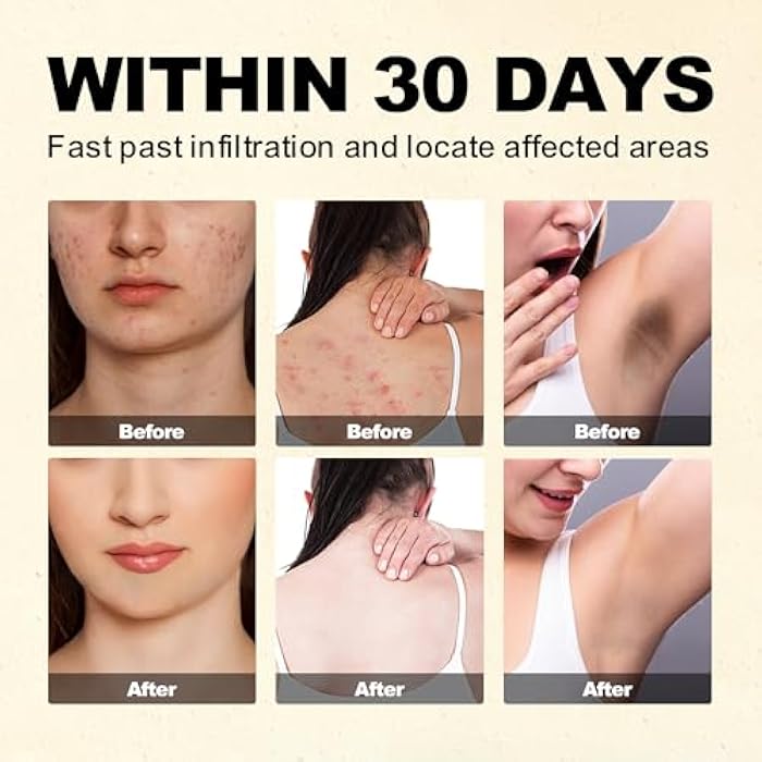 ENVISHA Bee Venom Cream, All-Body Skin Treatment, Natural Skin Moisturizer, New Bee Venom Skin Cream for All Types - Image 4