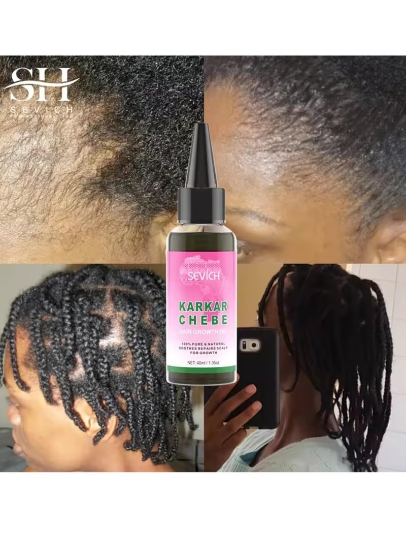 Sevich - Karkar Chebe Hair Growth Oil 100% Pure and Natural Soothes Repairs Scalp for Hair Growth with Karkar and Chebe Rosemary and Castor Seed Oil Moisturize Hydrate Prevent Hair Breakage Chebe oil 40ml - Image 1
