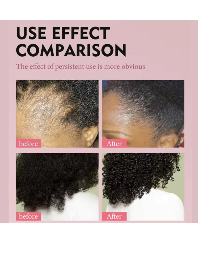 Sevich - Karkar Chebe Hair Growth Oil 100% Pure and Natural Soothes Repairs Scalp for Hair Growth with Karkar and Chebe Rosemary and Castor Seed Oil Moisturize Hydrate Prevent Hair Breakage Chebe oil 40ml - Image 1