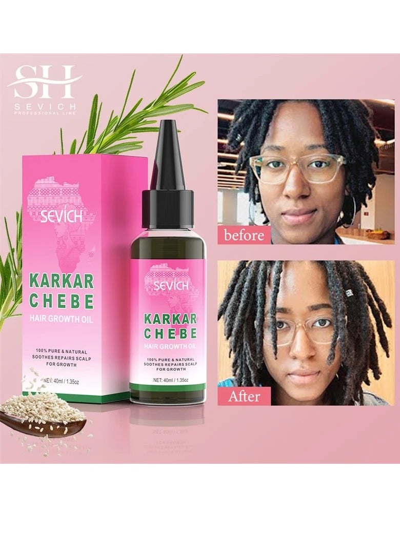 Sevich - Karkar Chebe Hair Growth Oil 100% Pure and Natural Soothes Repairs Scalp for Hair Growth with Karkar and Chebe Rosemary and Castor Seed Oil Moisturize Hydrate Prevent Hair Breakage Chebe oil 40ml - Image 1