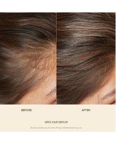 VEGAMOUR VEGAMOUR GRO Hair Serum for Hair Thinning, Thicker Fuller Looking Hair, Non Oily, 1.7 fl oz, 1 pack  - Image 4