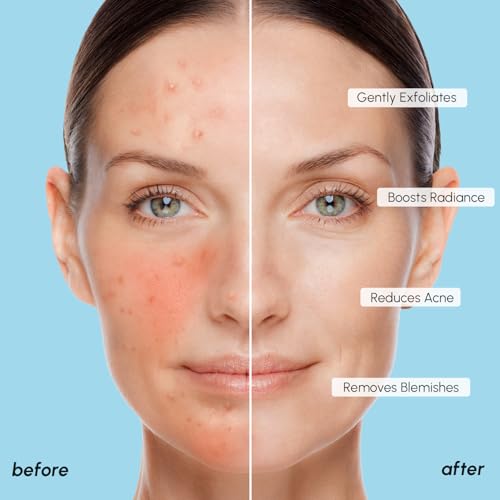 MAREE Glycolic Acid Polishes 2 PACK - Toner Polishes for Face Cleansing - Tea Tree Oil, Salicylic Acid & Vitamins E, B3, B5 - Facial Peel & Radiance Deep Cleaning Effect - Image 5