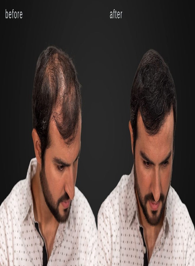LUXE Professional ألياف تكثيف الشعر الفاخرة للجنسين، الثقة في جرة، إمداد لأكثر من 2 شهر. مضادة للحساسية، مختبر من قبل أطباء الجلد، متوفر بألوان متعددة (أسود) - Image 4